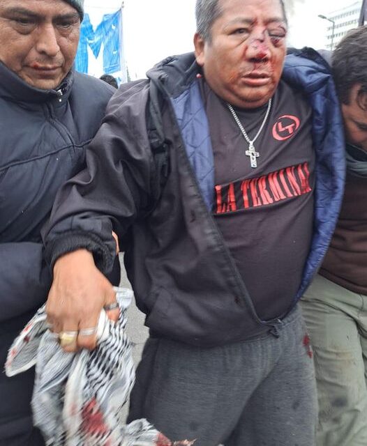 TRABAJADOR MUNICIPAL PIERDE UN OJO EN LA BRUTAL REPRESION DE GERARDO MORALES